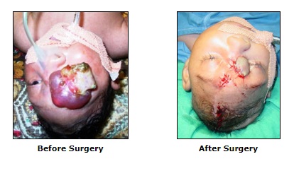 Reconstructive Surgery, Congenital Deformities Surgery