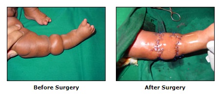 Reconstructive Surgery, Congenital Deformities Surgery